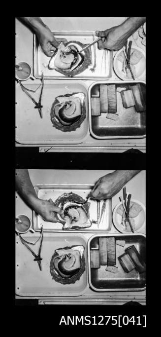 Two black-and-white negatives, joined together, both showing three containers, two of which contain one pearl shell each, surrounded by pearl seeding equipment, and a mans' hand using an instrument on the flesh of the pearl shell