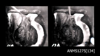 Two black-and-white negatives, joined together, both of a pearl shell with the inner flesh still attached