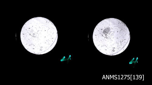 Two black-and-white negatives, joined together, both of cells, as seen through a microscope