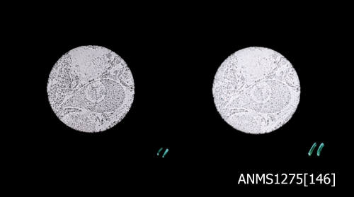 Two black-and-white negatives, joined together, both of cells, as seen through a microscope