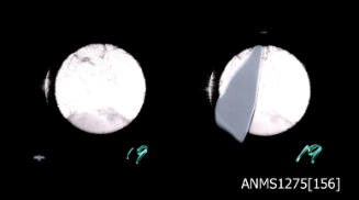 Two black-and-white negatives, joined together, both of cells, as seen through a microscope