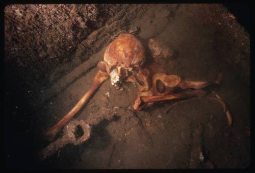 Human skull and bones at the site of a shipwreck