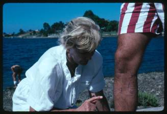 Valerie Taylor pointing at shark attack scars on the shin of a person