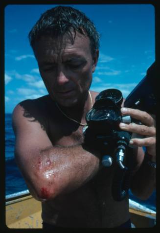 Ron Taylor looking at a shark bite on his arm and elbow