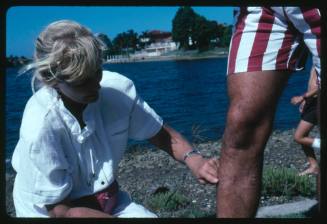 Valerie Taylor pointing at shark attack scars on the shin of a person