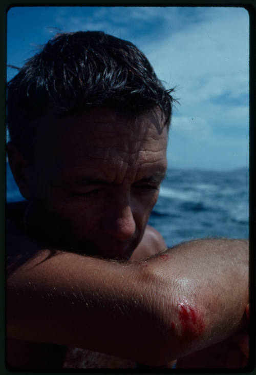 Ron Taylor holding up his arm which has fresh wounds from a shark attack