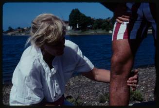 Valerie Taylor inspecting shark bite injury on Ron Taylor's left leg