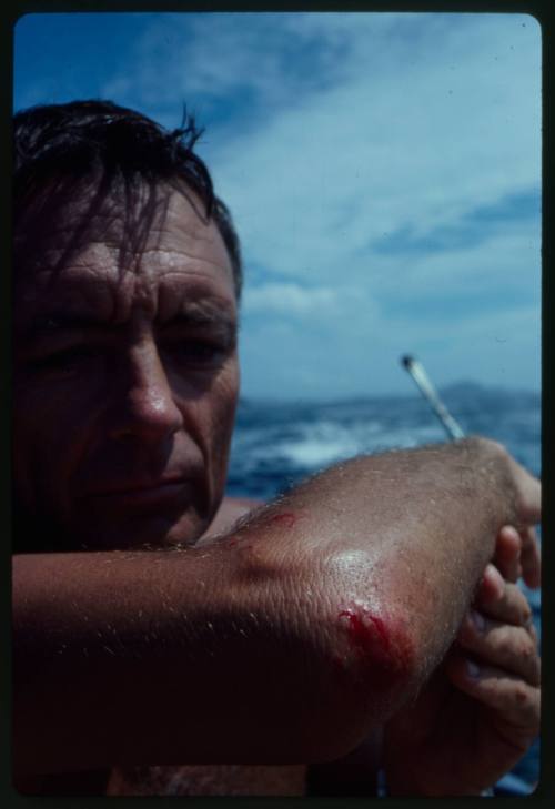 Portrait shot of Ron Taylor on deck of boat at sea holding his left elbow while it bleeds